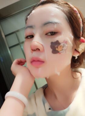 硅胶隆鼻+耳软骨垫鼻尖果图 很满意