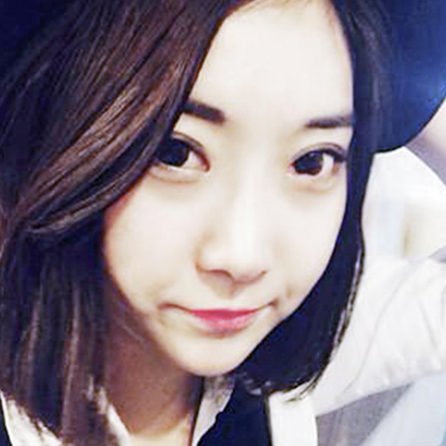 米兰柏羽做了外切去眼袋，分享手术前后对比果图片哦~