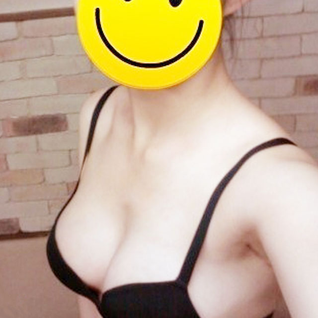 自体脂肪移植隆胸恢复过程和前后对比果图片分享哦~