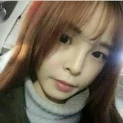 玻尿酸注射隆鼻三个月了，分享术后恢复照片哇~