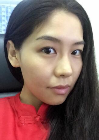 做埋埋蛋白线.提升手术