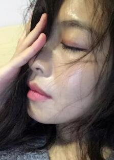 埋埋蛋白线.提升一个多月了