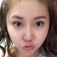 做鼻部综合整形真是一件正确的决定，鼻子恢复过程分享