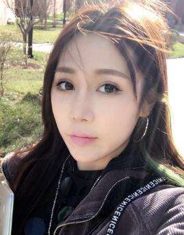 隆鼻整形第八天，拆线了