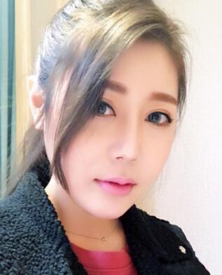 鼻子整形恢复经历分享