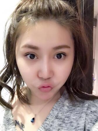 鼻子整形2个多月了，差不多基本恢复了，可以任意揉捏