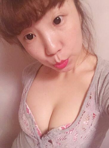 自体脂肪隆胸2个月真实经历