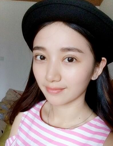 微创双眼皮恢复过程图