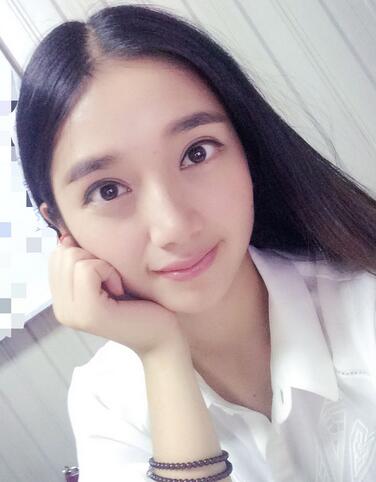 微创双眼皮恢复过程图