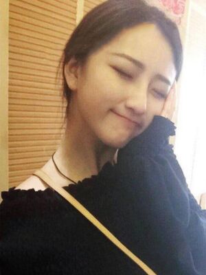 膨体隆鼻+垫鼻尖前后对比图，拥有小巧美鼻