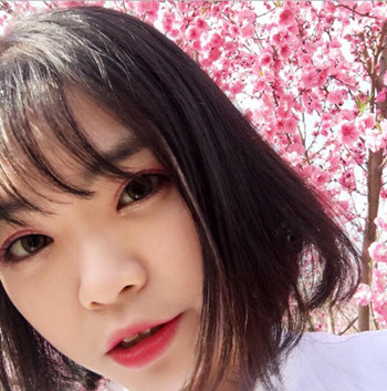 我的全切双眼皮整形经历 内有真实果图