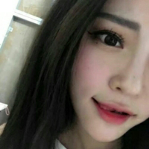 做了隆鼻整形手术好看多了，分享前后对比果照片~