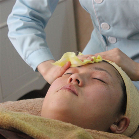 激光去雀斑前后对比果图片分享，福州海峡林珑医生做的~