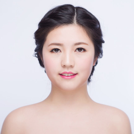 激光去雀斑前后对比果图片分享，福州海峡林珑医生做的~