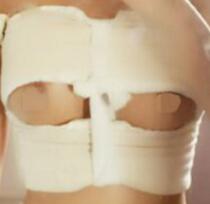 假体隆胸设计的手术方案是：腋下切口，进口品牌毛面水滴假体，胸部由A丰到C