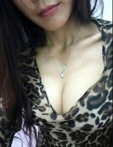 假体隆胸3个月，腋下伤口已经基本恢复