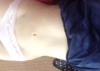 吸脂减肥恢复图，腰上伤口还未完全恢复