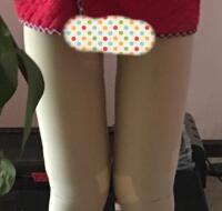 今年去做了大腿吸脂减肥手术，吸脂果挺好的