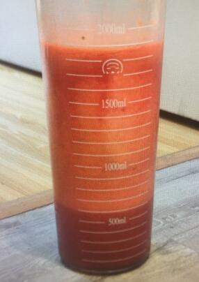 吸脂减肥手术抽出这么多大腿脂肪