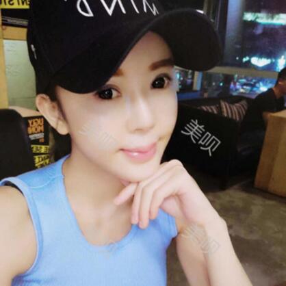 自体脂肪全脸填充让我变得年轻漂亮了