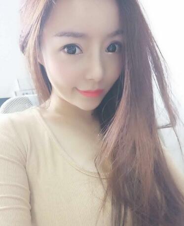 发际线调整案例分享 北京熙朵发际线+眉毛种植