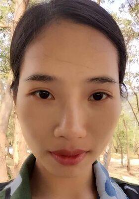 假体硅胶隆鼻真实感想分享~