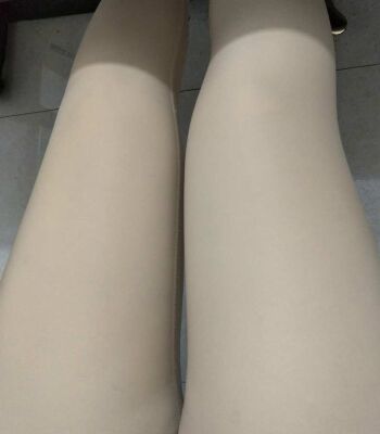 大腿抽脂日记 记录一下腿部变化