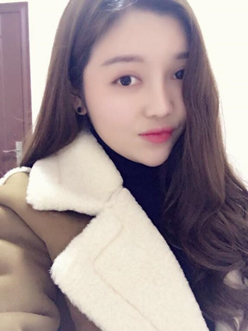 做了自体脂肪填充全脸果还不错 现在请叫元气少女