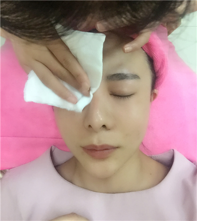 北京延世金慧燕做的果酸嫩肤，分享手术过程和前后对比果照片~