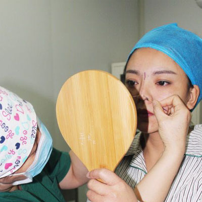 自体脂肪隆鼻手术恢复过程分享，还有前后对比果图片哦~