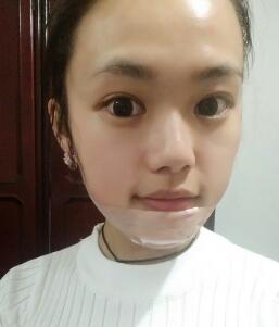 硅胶假体垫下巴整形手术后的这几天