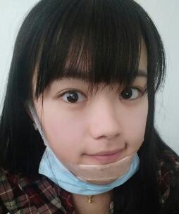 硅胶假体垫下巴整形