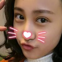 割双眼皮恢复过程分享，整形价格3800元