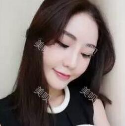 杭州广仁做的硅胶假体隆鼻+鼻翼缩小我很满意