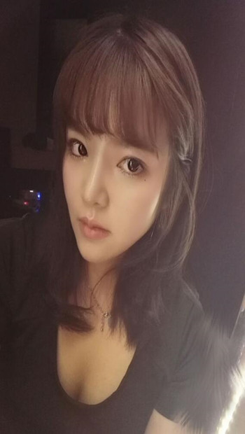 隆鼻整形手术后  我的高鼻梁养成记 内有果对比图