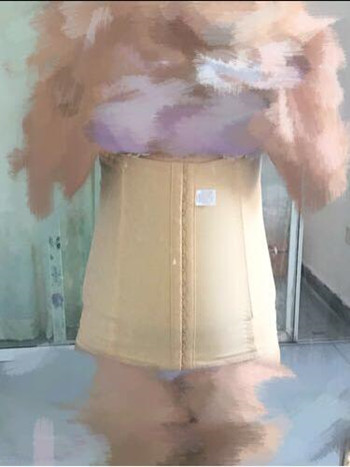 我的腰腹部吸脂减肥真实案例