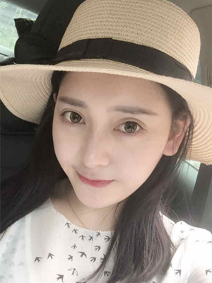 自体软骨隆鼻手术前后过程以及对比照片分享