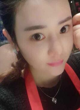 自体脂肪丰太阳穴一个月了