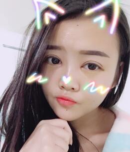 自体脂肪面部填充恢复