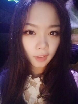 全切双眼皮手术，送给自己的成年礼物