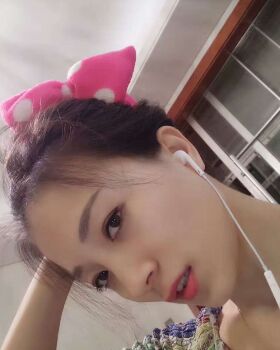 激光去眼袋成好吗，看看我就知道啦