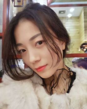 激光去眼袋成好吗，看看我就知道啦