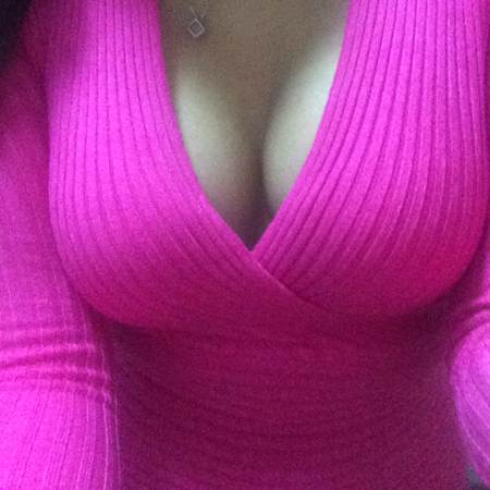 妙桃琴面假体隆胸术后半年恢复过程照片分享，沈阳金皇后做的~