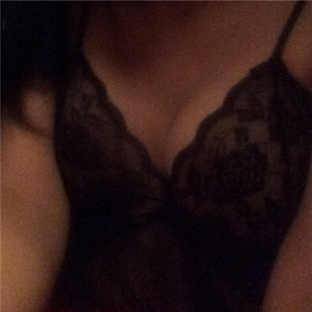 妙桃琴面假体隆胸术后半年恢复过程照片分享，沈阳金皇后做的~