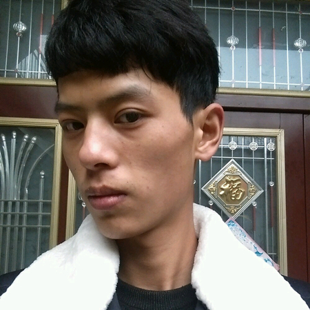 内切去眼袋+切开割双眼皮恢复过程和前后对比果图片分享哦~