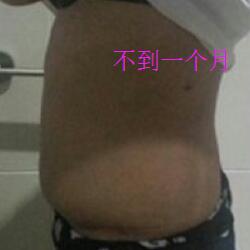 肚子减肥的方法就是吸脂减肥瘦腰腹了，亲身经历分享