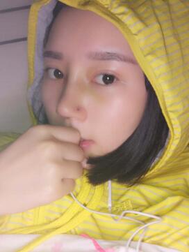 鼻子整形术后一周了，终于拆线