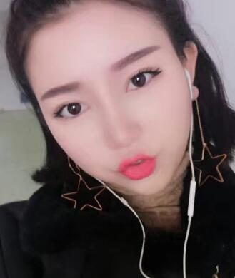 隆鼻手术刚好一个月了