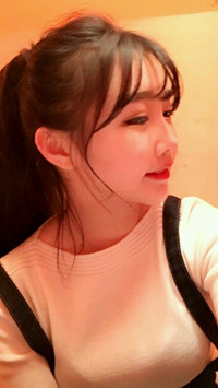 颧骨整形手术后，我也可以拥有精致小脸了