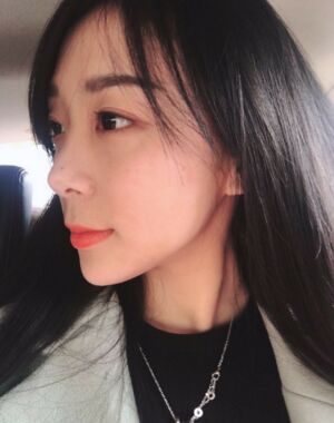 面部埋x后的恢复过程 快来看看我的果吧